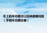 手上的半月痕可以反映健康問題（手相半月痕診?。? /></span></a>
                        <h2><a href=