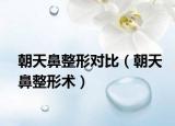 朝天鼻整形對比（朝天鼻整形術）