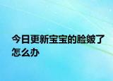 今日更新寶寶的臉皴了怎么辦