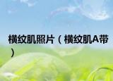 橫紋肌照片（橫紋肌A帶）
