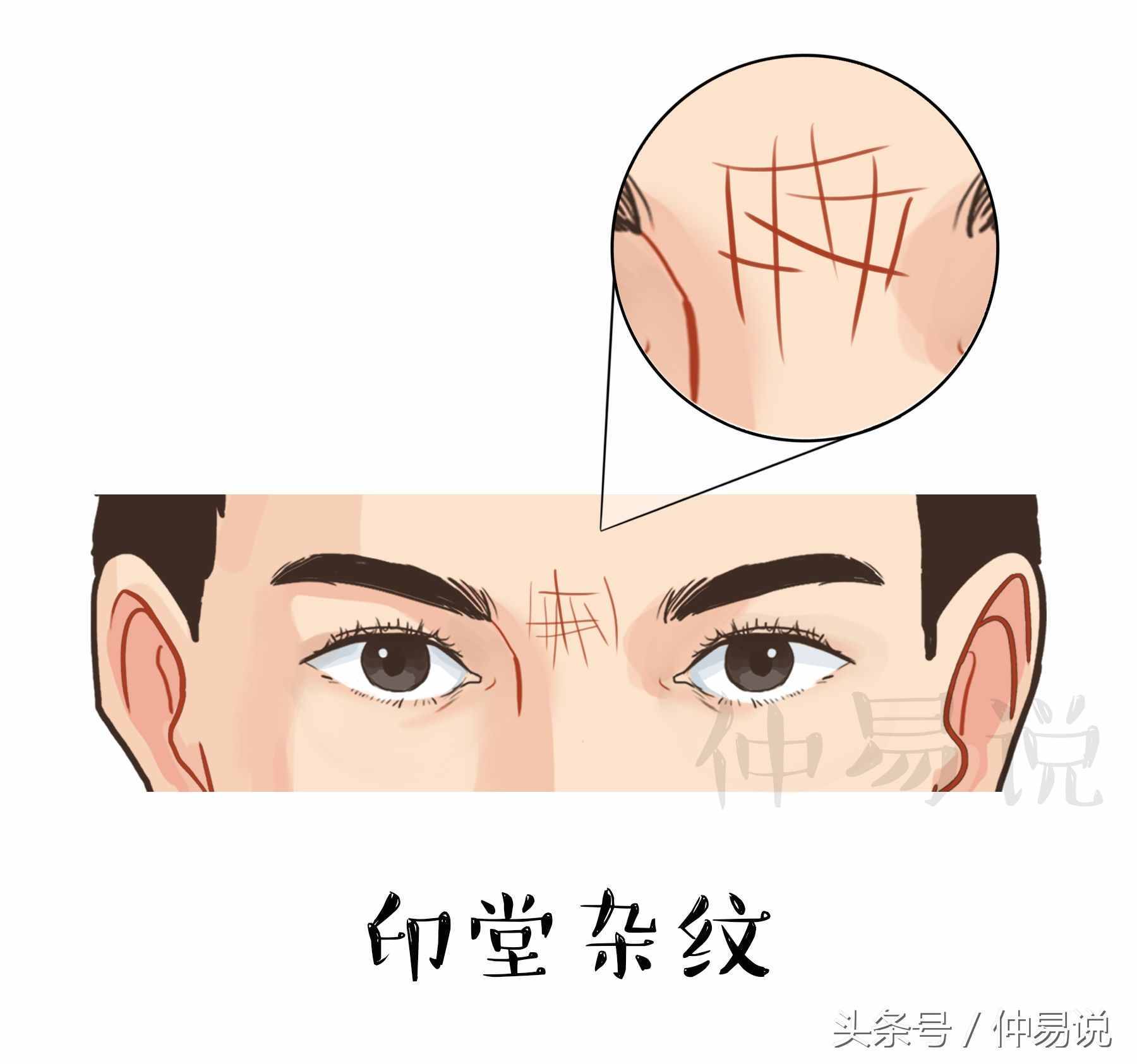 4種印堂的紋路，看你今生是富貴命還是勞碌命