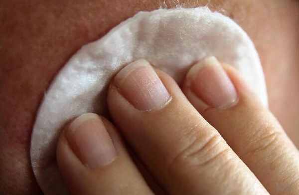 蚊子咬了怎么消腫止癢最快，這六個方法能緩解蚊子咬的痛苦