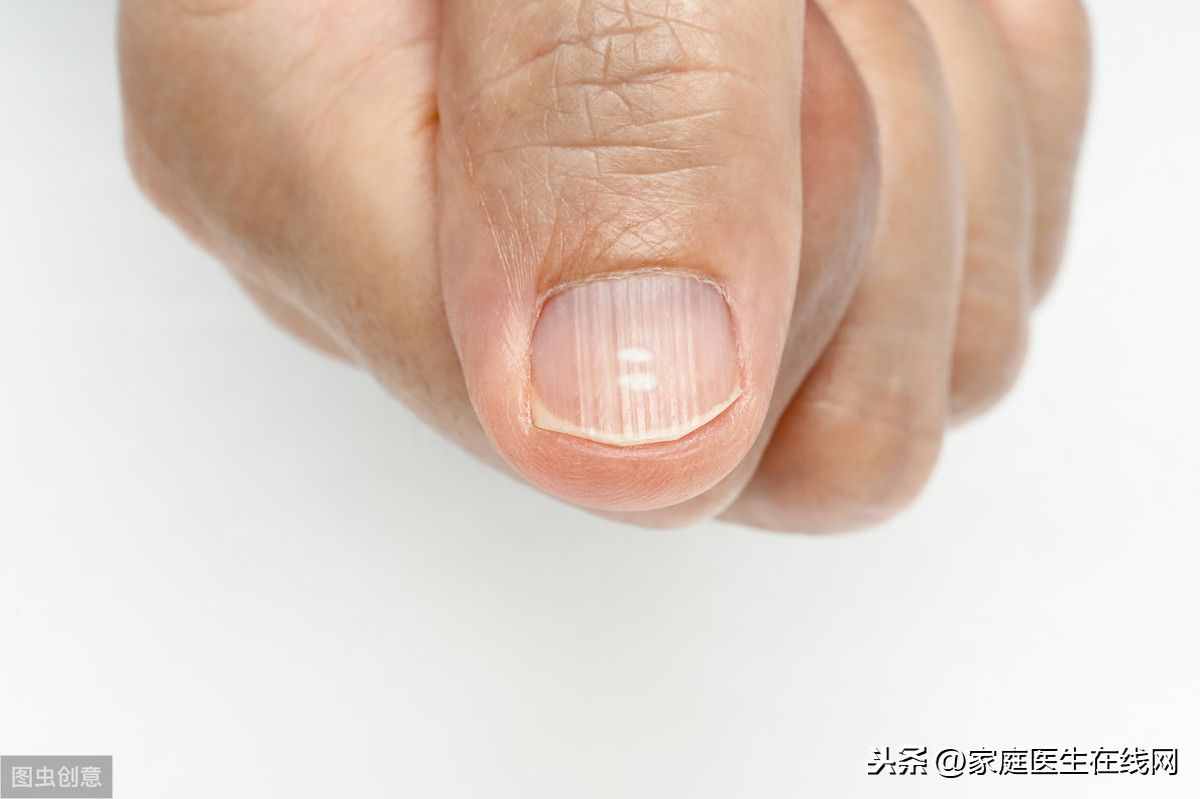 指甲有豎紋是怎么回事？總結(jié)6個(gè)原因，都要重視