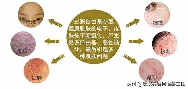 天天在說抗氧化，抗氧化到底是什么？大多數(shù)人沒搞懂它