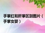 手掌紅和肝掌區(qū)別圖片（手掌女嬰）