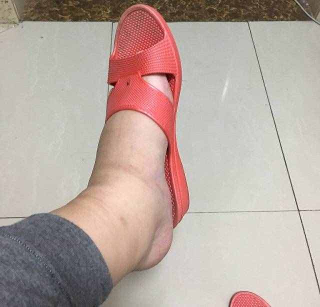懷孕后，孕媽雙腳浮腫怎么辦？3個(gè)原因及4種緩解方法，請(qǐng)收藏