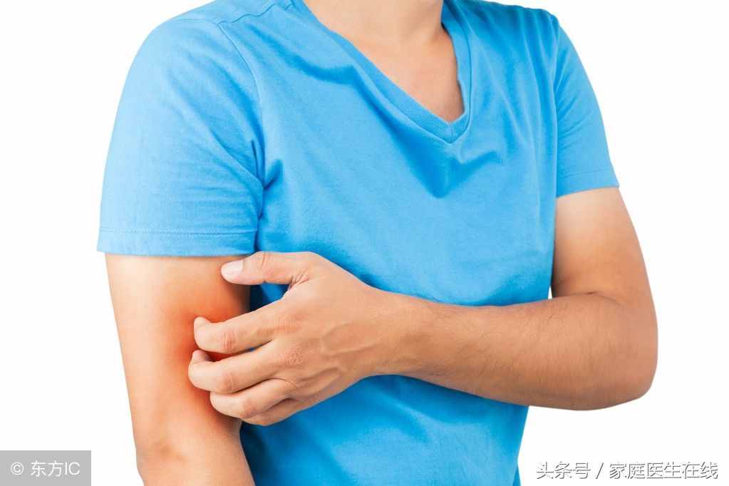 被蟲子叮咬怎么辦？這4種處理方法，收藏后必有用