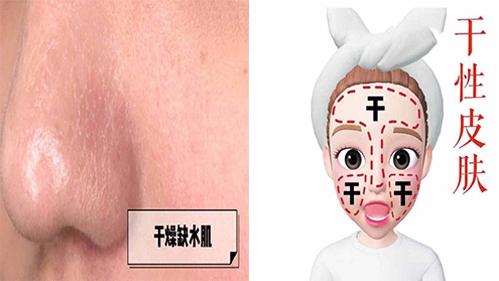 油田？干皮？混合??？5秒測出你是什么膚質(zhì)！也太準(zhǔn)了吧？