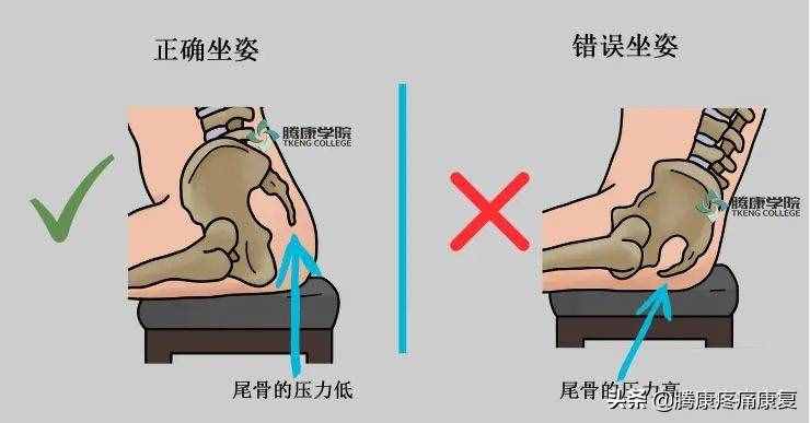 四個(gè)緩解尾骨疼痛的方法