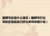 胳膊彎淤血什么情況（胳膊彎打出來的淤血能自己擠出來嗎詳細(xì)介紹）
