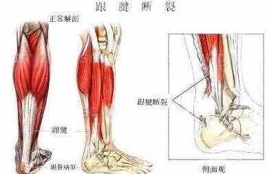 常見(jiàn)的幾種足底疼痛，哪些原因引起的呢？