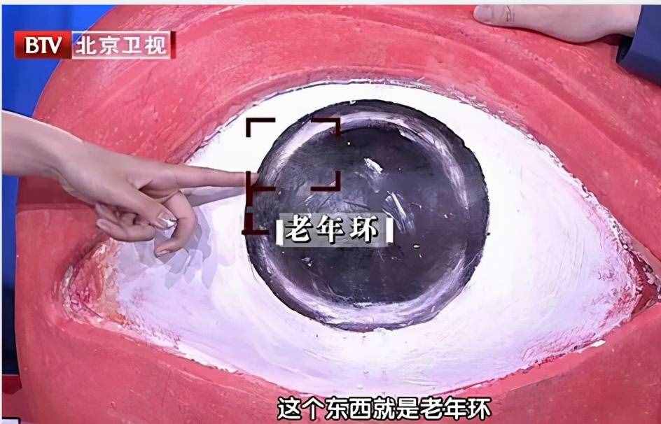 血脂高，別急著吃藥！為你總結(jié)：5個方法降血脂，不用吃藥也能降