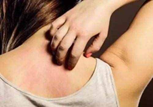 蚊子為啥總叮你？這4類人才是蚊子的最愛，驅蚊方法學起來