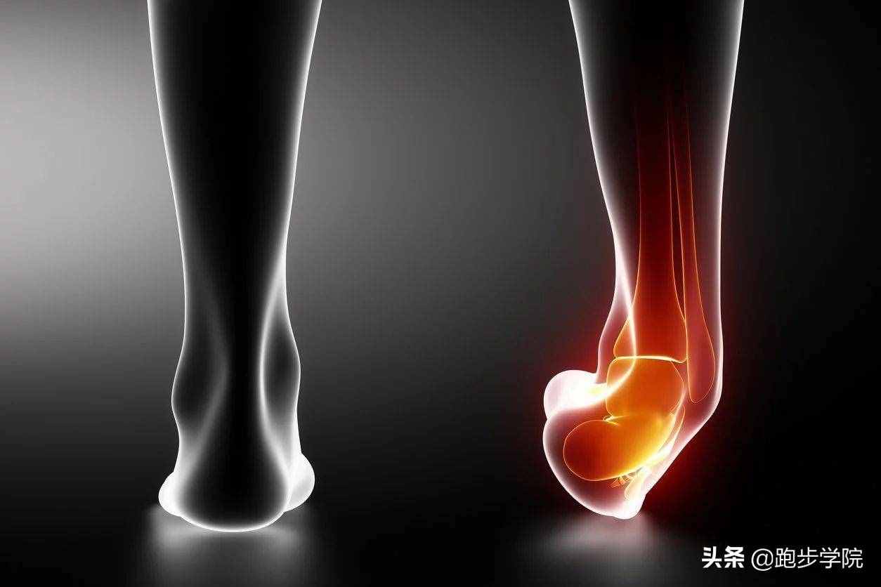 關(guān)于腳踝扭傷的所有干貨，都在這了
