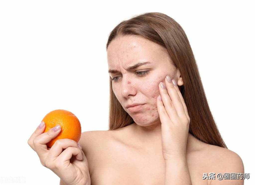 皮膚過敏怎么辦？