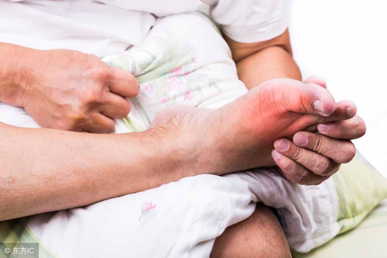 出現(xiàn)大腳趾疼痛的情況，并不一定就是痛風(fēng)引起的，得謹(jǐn)記了