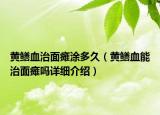 黃鱔血治面癱涂多久（黃鱔血能治面癱嗎詳細(xì)介紹）