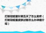 打新冠疫苗針第五天了怎么發(fā)癢（打新冠疫苗皮膚過(guò)敏怎么辦詳細(xì)介紹）
