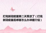 打完新冠疫苗第二天受涼了（打完新冠疫苗后感冒怎么辦詳細(xì)介紹）