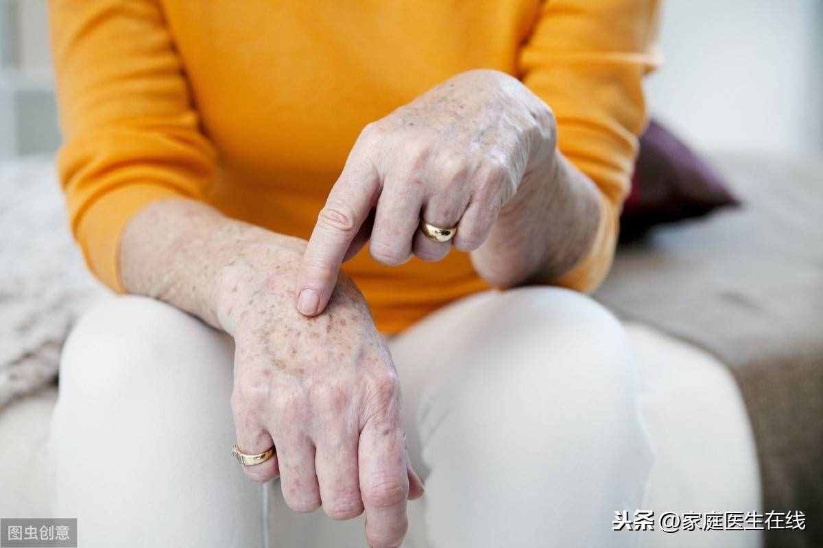 老年斑會癌變嗎？長了老年斑，這幾個方法或許能去除