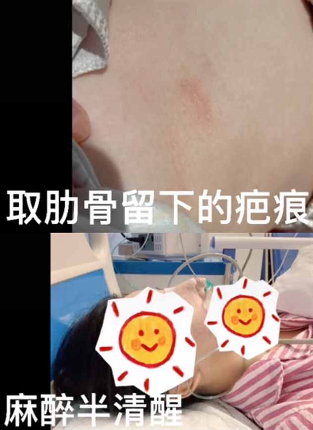 千萬(wàn)粉網(wǎng)紅承認(rèn)整容失敗！自嘲鼻子又大又高像巫婆，不停手術(shù)修復(fù)
