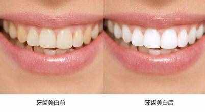 美白牙膏真的能美白么？我們測評了10款美白牙膏，結(jié)果