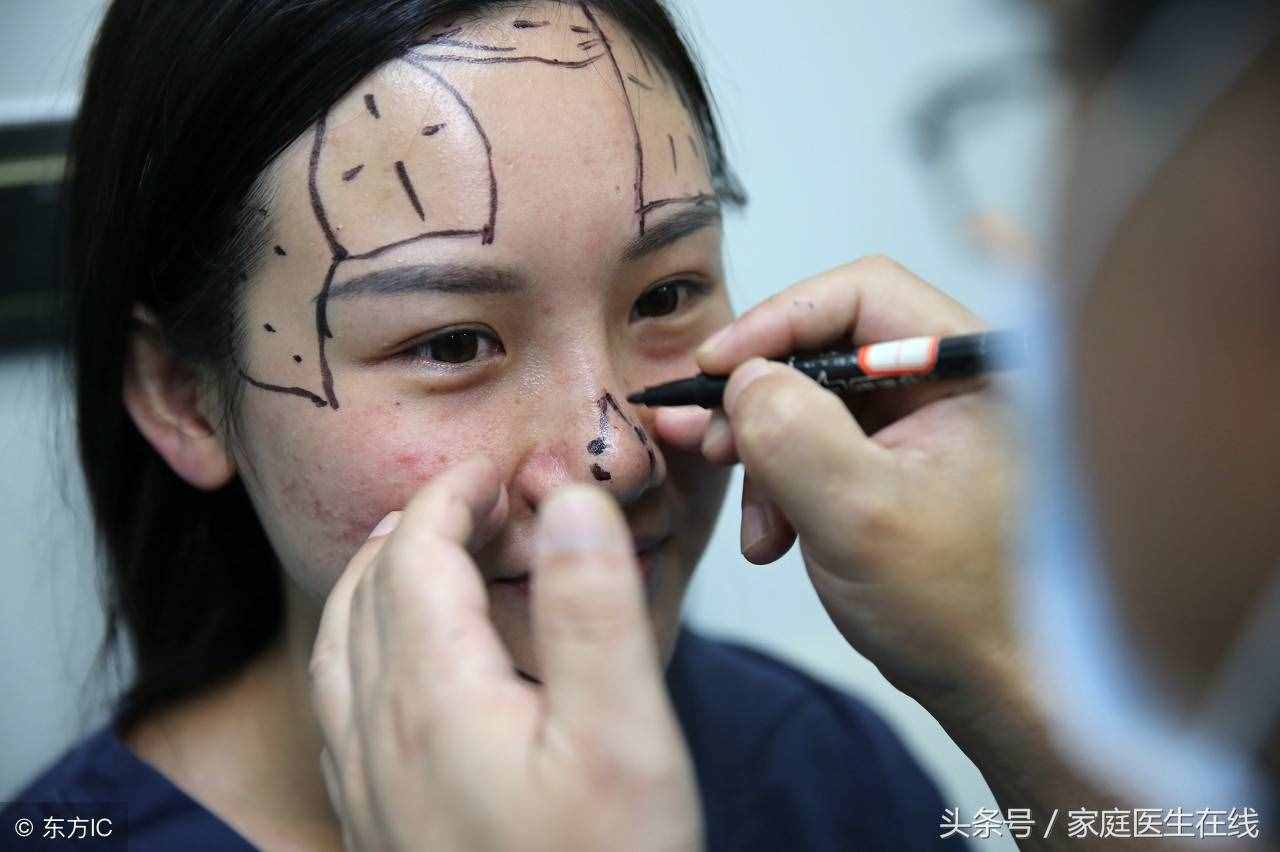 整容后會(huì)不會(huì)留下后遺癥？這個(gè)答案，醫(yī)生不隨便告訴你