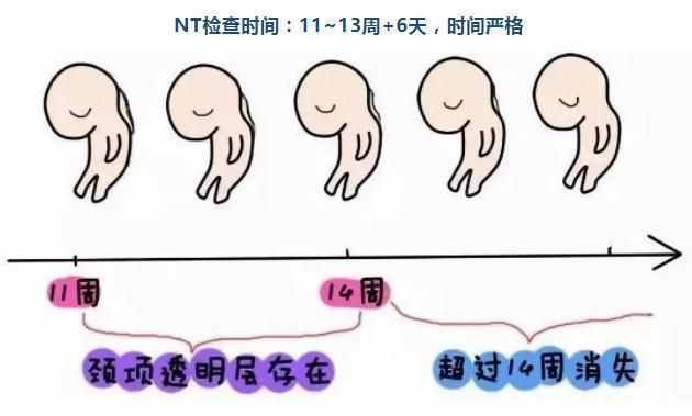 什么是NT檢查、懷孕多少周做、結(jié)果異常咋辦，10個(gè)問(wèn)題帶你了解NT
