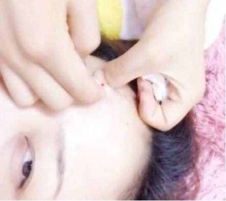 學(xué)生怎么祛痘痘？每天5毛錢讓你輕松祛痘不留痕