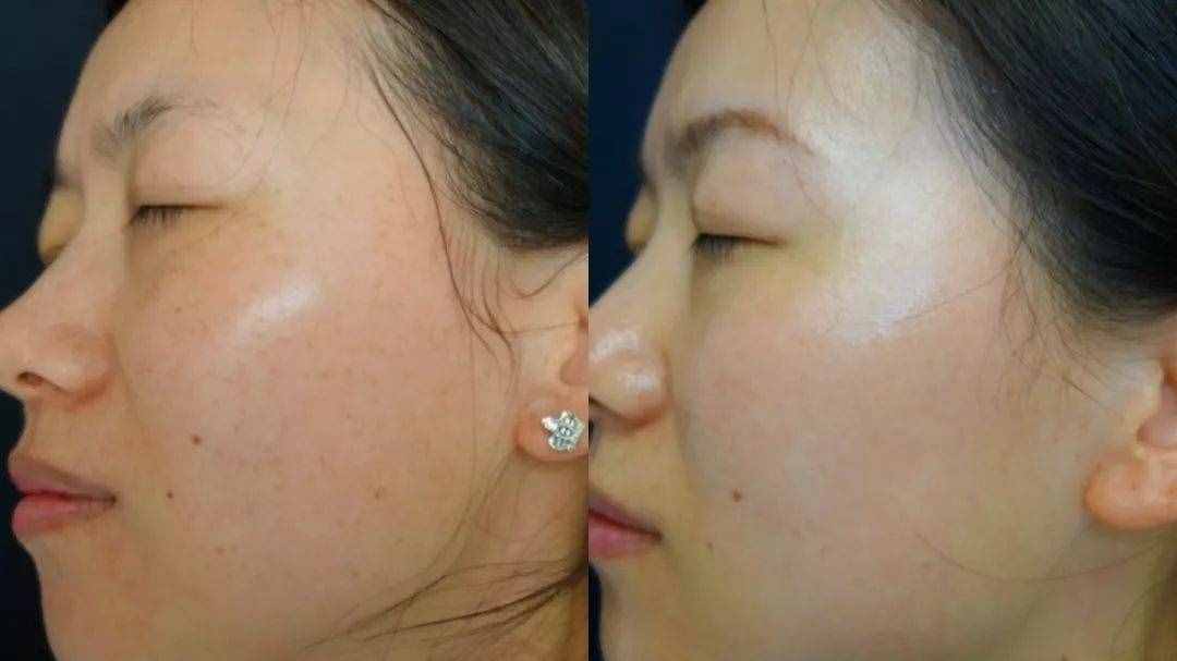 堅(jiān)持這 3 個(gè)美白方法，你可能早就白了