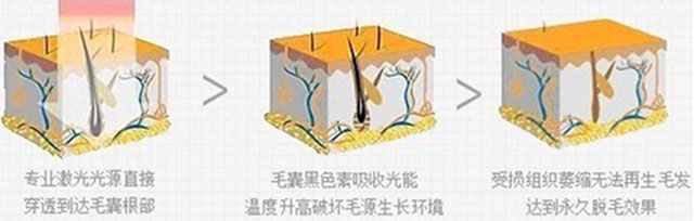 一根棉線擔當的脫毛“神器”！