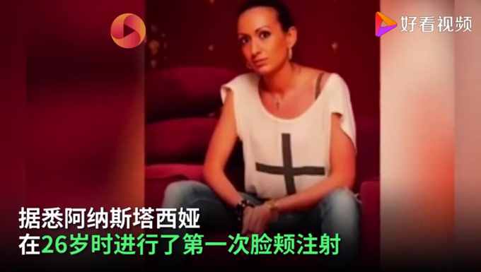 烏克蘭網(wǎng)紅模特自稱擁有世界最大臉頰，網(wǎng)友們看法不一