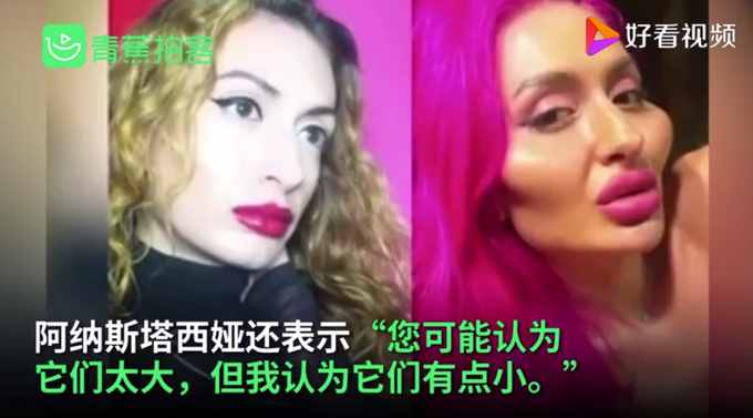 烏克蘭網(wǎng)紅模特自稱擁有世界最大臉頰，網(wǎng)友們看法不一