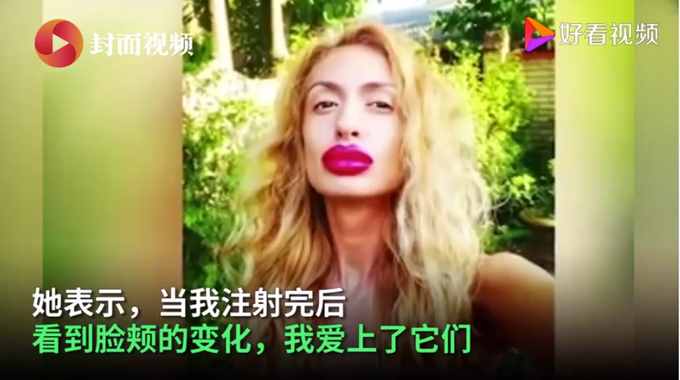 烏克蘭網(wǎng)紅模特自稱擁有世界最大臉頰，網(wǎng)友們看法不一