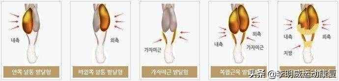 如何瘦小腿？原因和練習(xí)方案