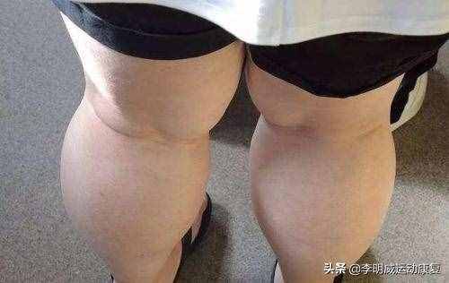 如何瘦小腿？原因和練習(xí)方案