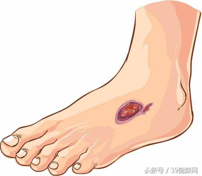 光腳走鵝卵石的好處那么大，但4種“危險(xiǎn)足”不宜走