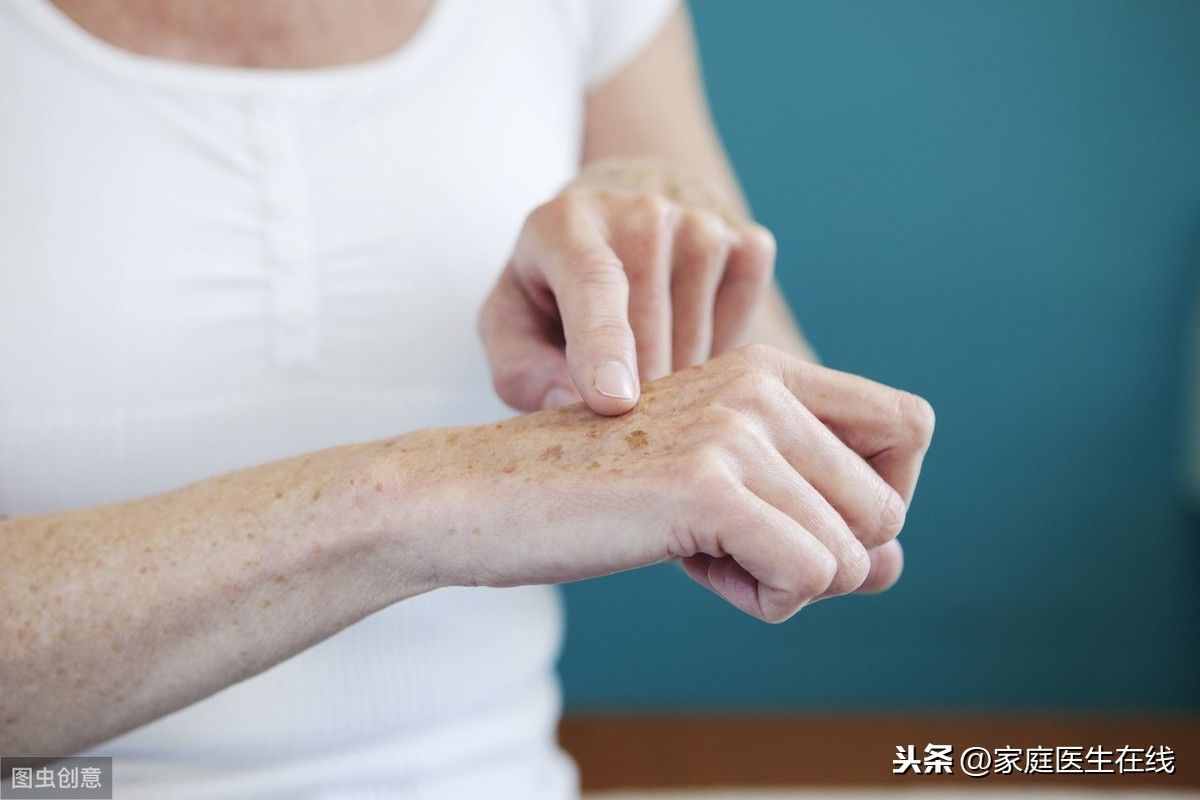 老年斑會(huì)癌變嗎？長(zhǎng)了老年斑，這幾個(gè)方法或許能去除