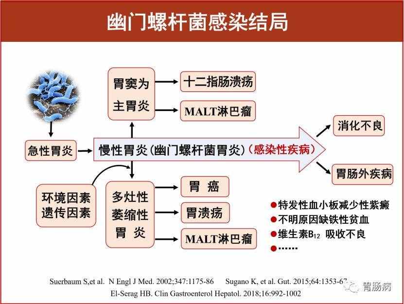 胃病都有哪些，什么癥狀