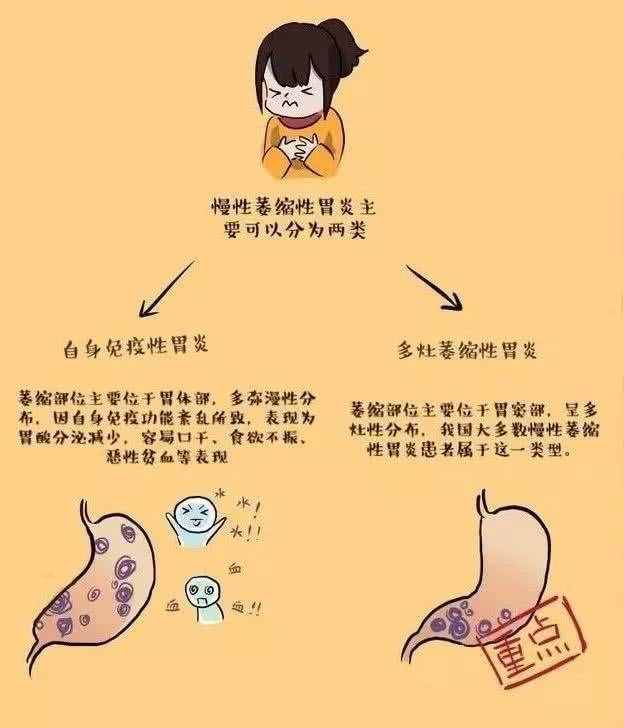 胃病都有哪些，什么癥狀