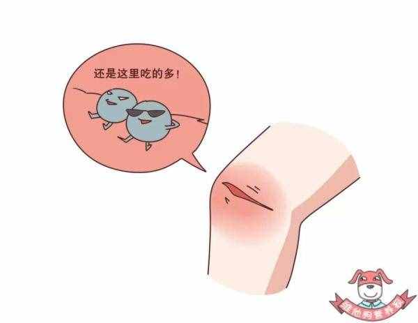 不知不覺得了糖尿病？這些早期癥狀你要了解