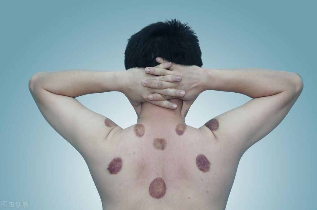 男人濕氣重怎么排濕？男性濕氣重的癥狀介紹
