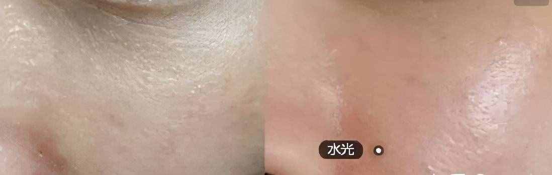 針對(duì)不同年齡，分享面部松弛下垂的解決辦法，非常實(shí)用