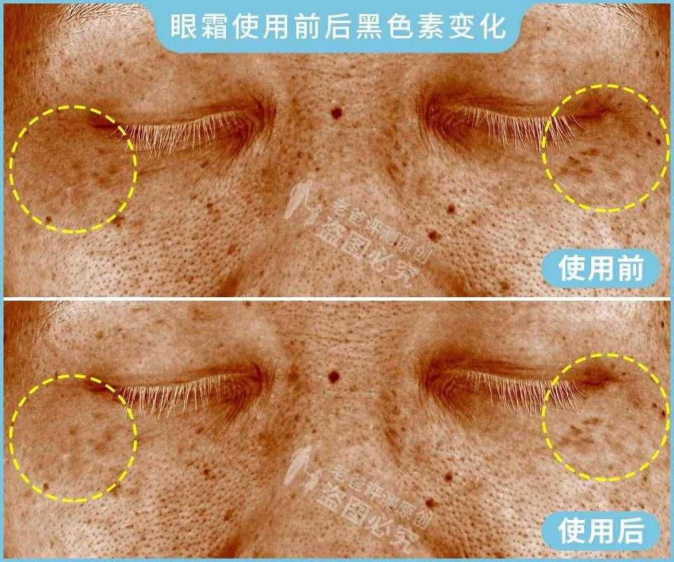 眼霜真的對黑眼圈、細紋有效嗎？1個月跟蹤實測結(jié)果來了