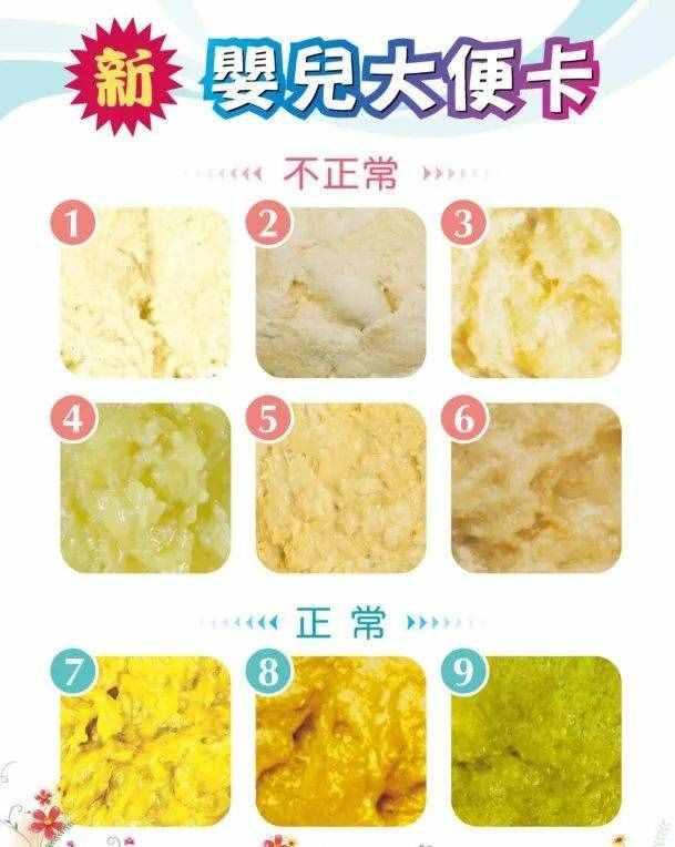 新嬰兒大便對照表！快來對照一下你家寶寶的大便是否正常！