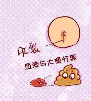 新嬰兒大便對照表！快來對照一下你家寶寶的大便是否正常！