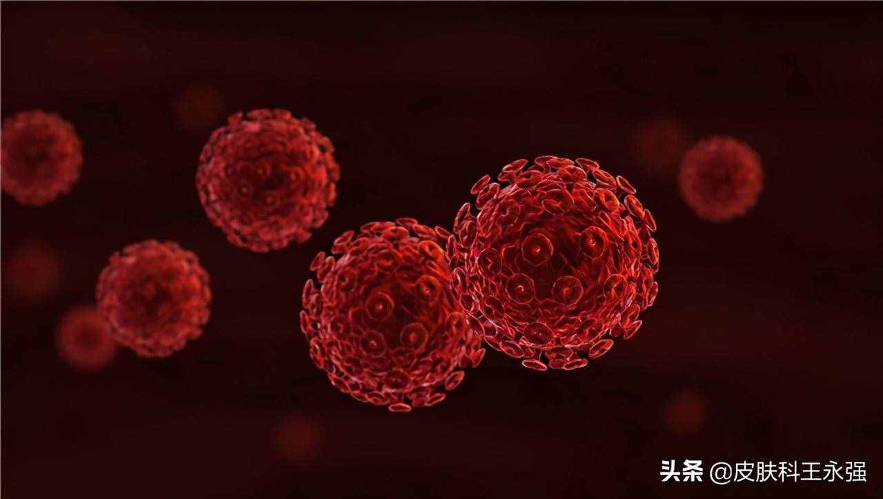 艾滋病患者，前期會(huì)有哪些表現(xiàn)？怎樣正確的預(yù)防，醫(yī)生一步步教你
