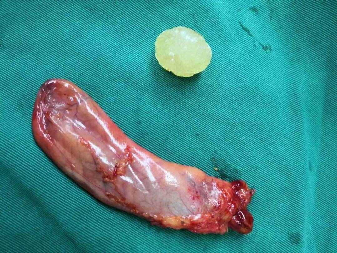 佛的舍利子到底是什么呢？我研究了一下...