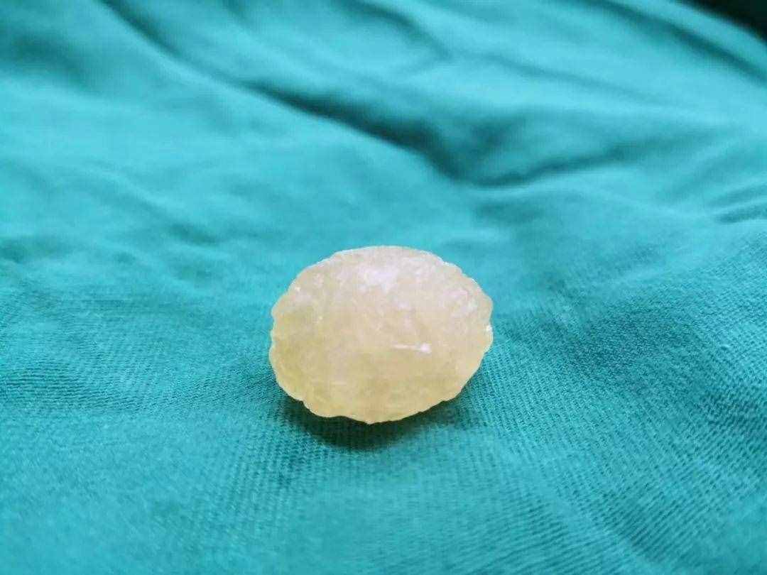 佛的舍利子到底是什么呢？我研究了一下...