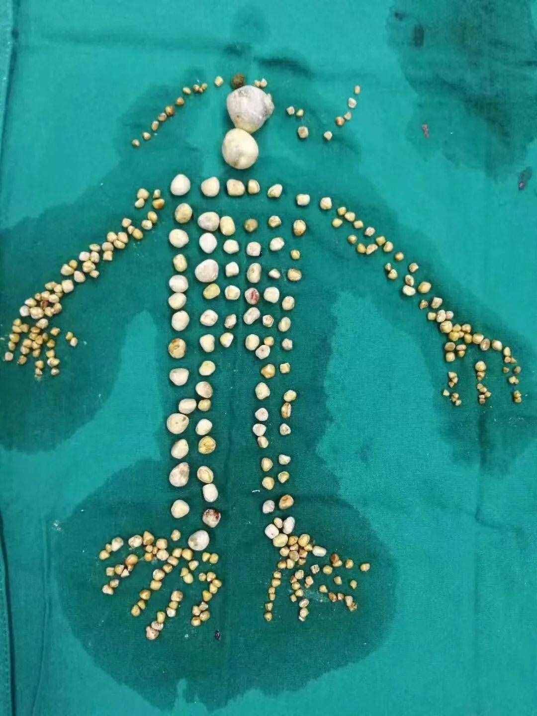 佛的舍利子到底是什么呢？我研究了一下...